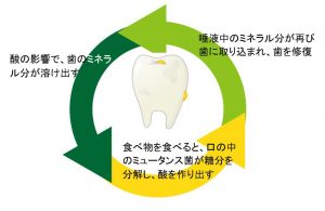 虫歯のメカニズム